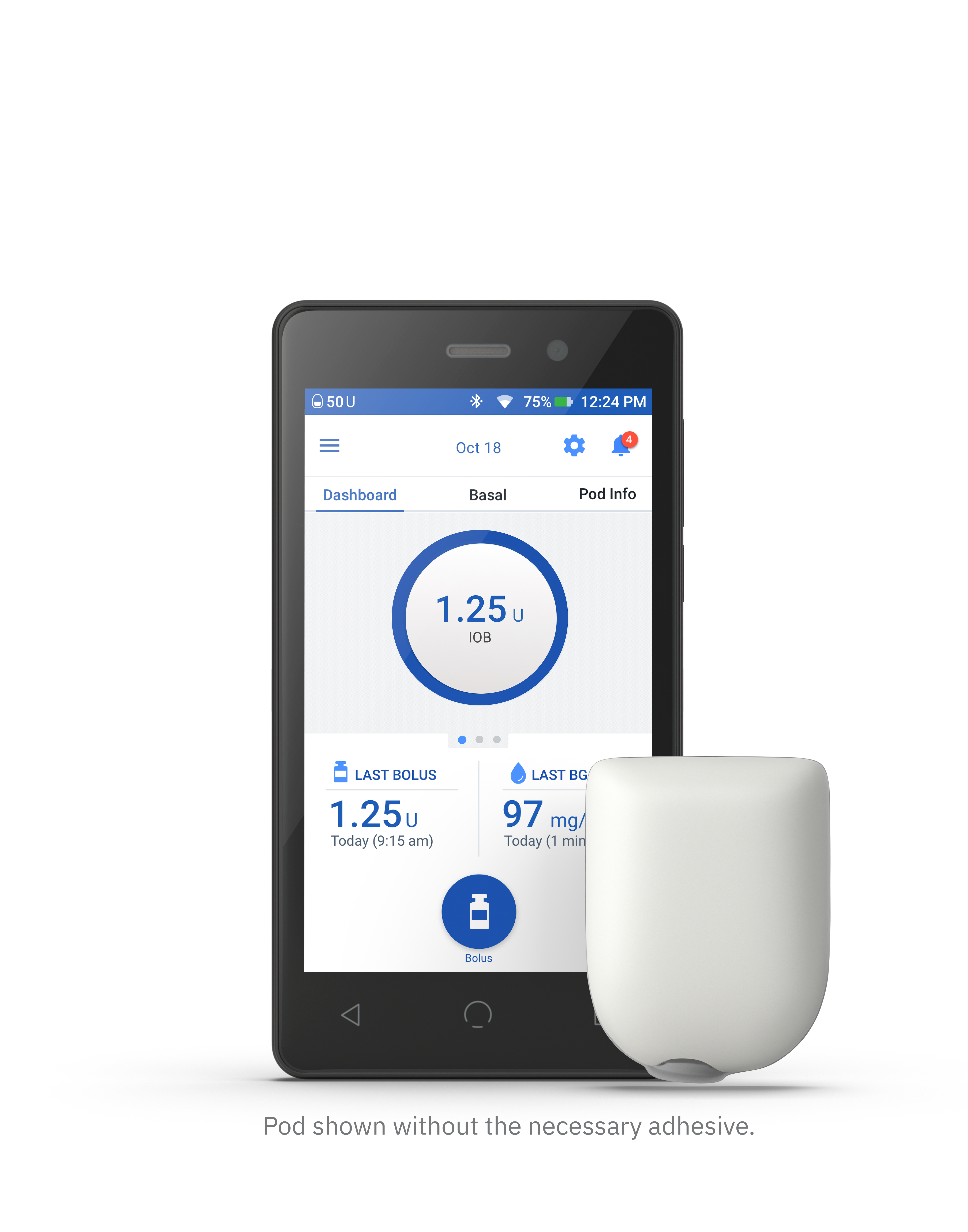 The Insulin Pump (omnipod) is a widely used medical treatment during the 2020s.